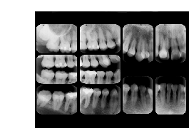Optimagen Tumbaco: Líderes en Tecnología Dental Periapical y Panorámica