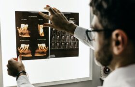¿Qué son los Rayos X Digital y donde puedes realizarlo en Ecuador?