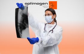 Imágenes de rayos X: los servicios avanzados de Optimagen en Tumbaco