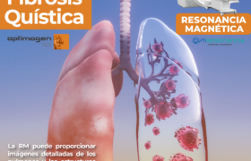 Detección Temprana de la Fibrosis Quística Exámenes de Imagenología en OPTIMAGEN