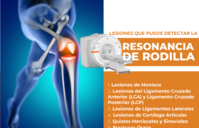 Resonancia Magnética de Rodilla: Entendiendo su Funcionamiento y Beneficios