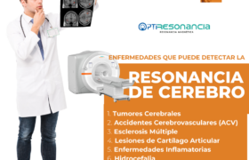 La Importancia de la Resonancia Magnética Cerebral en la Detección de Enfermedades Cerebrales