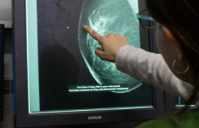 Detección del Cáncer de Mama: Los Nuevos Equipos de Mamografía