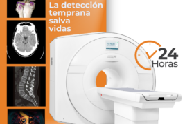 La Tomografía Multicorte y su Rol en la Detección de Enfermedades Cerebrales