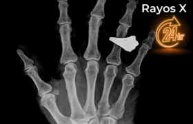 Radiología y Diagnóstico por Imagen en Tumbaco, Quito