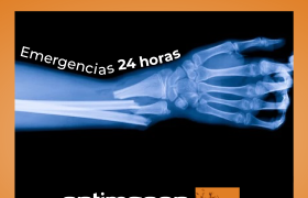 La Importancia de los Rayos X para Diagnosticar Lesiones en el Brazo tras un Accidente