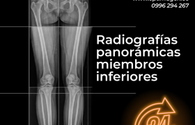 Radiografías Panorámicas de Columna y de Miembros Inferiores: Una Herramienta Esencial para el Diagnóstico