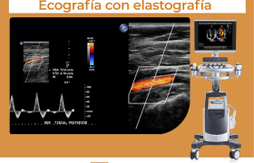 Ecografías con Elastografía: Innovación en Diagnóstico Médico en Quito