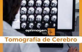 Tomografía de Cráneo para Traumas y Evaluación Inicial del Stroke en Quito