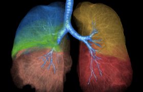 Evaluación del Volumen y Densidad Pulmonar en Tomografía – Servicio en Quito y Tumbaco